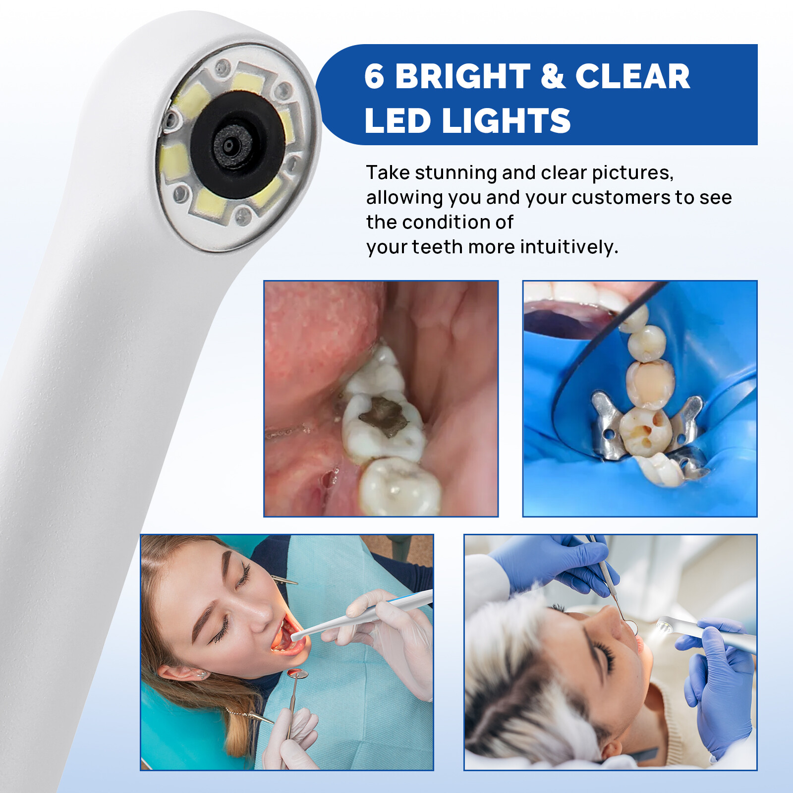 JMU Dental Intraoral Camera MD-280 Camera Capture Button Work on Dexis/Eaglesoft