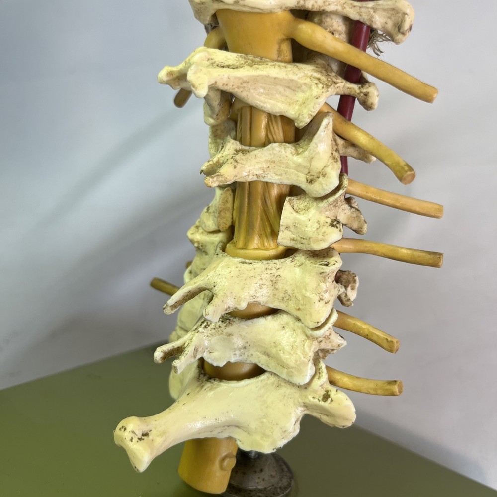 Somso Cervical Spinal Column Anatomical Model Vintage West Germany - Read