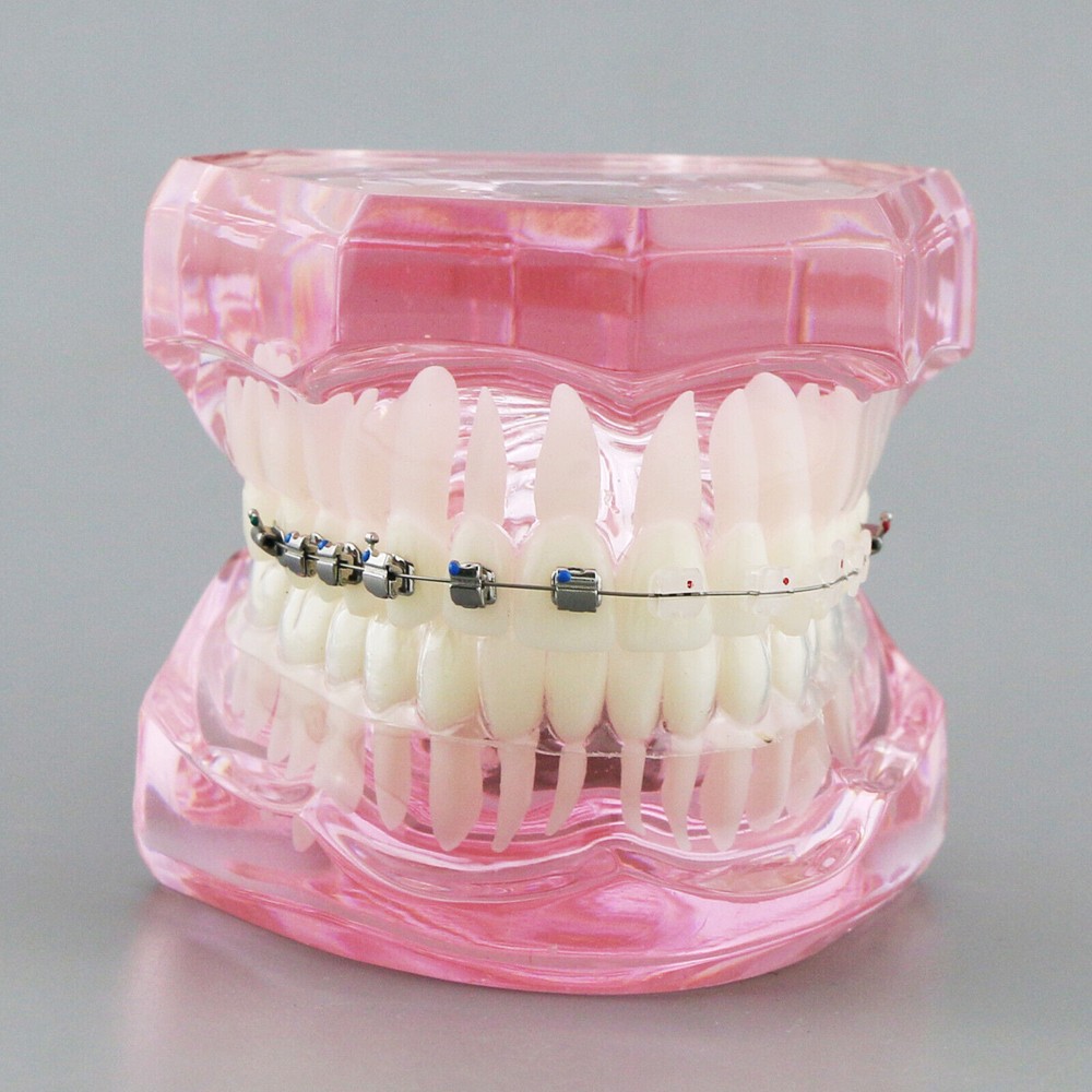 Dental Typodont Model Self-ligating Metal Bracket Ceramic Transparent Retainer