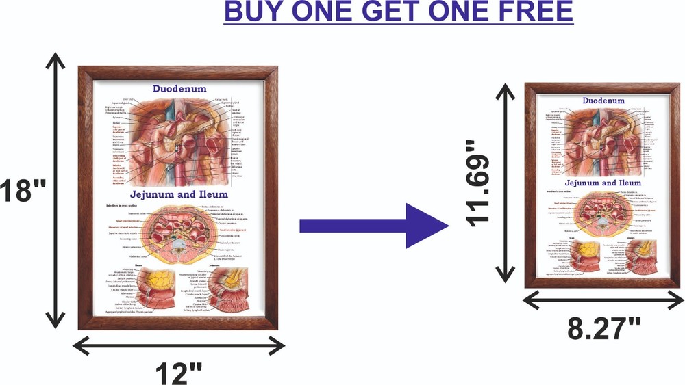 Duodenum Chart 12x18 inches