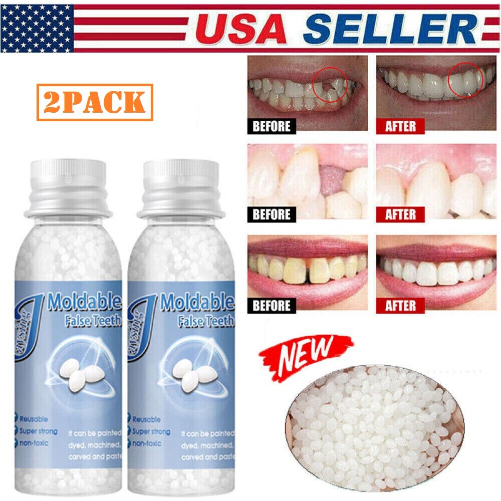 2×Resin False Teeth Solid Glue Temporary Tooth Repair Moldable Teeth Gap Denture