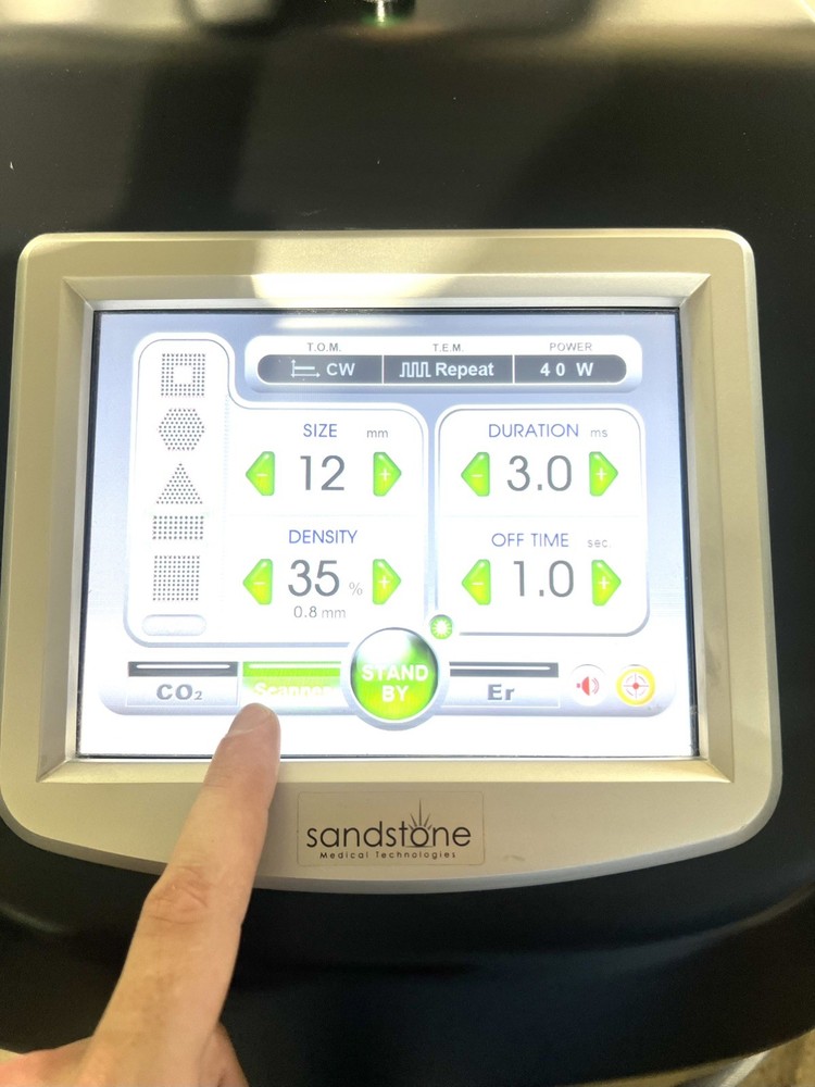 Sandstone Cortex Laser Co2 AND Erbium