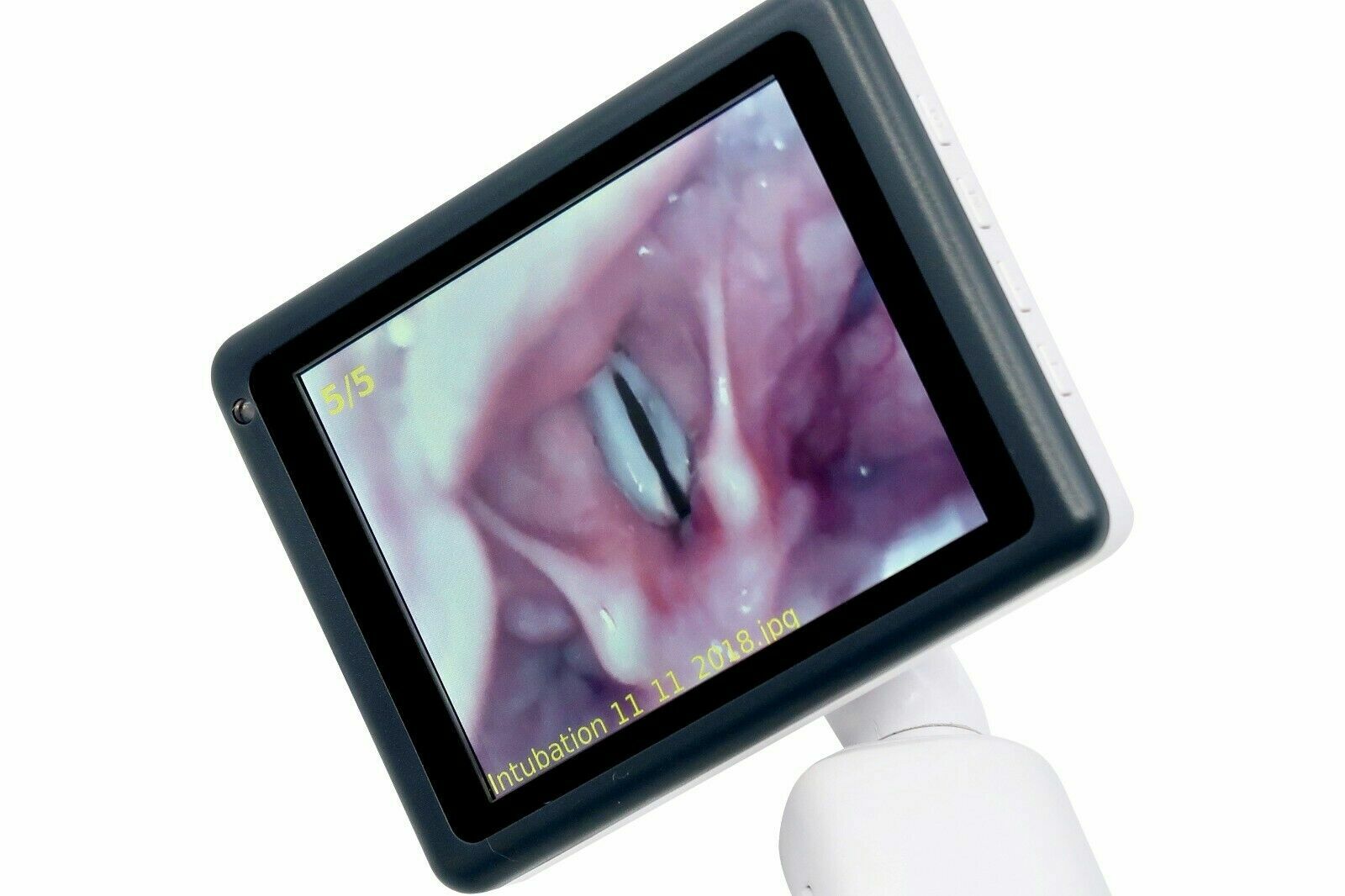 Airway Intubation HD Video Laryngoscope Kit Display Portable Rechargeable FDA