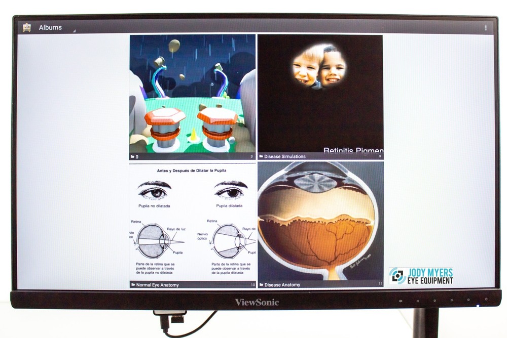 Lombart CVS Essential Vision Tester