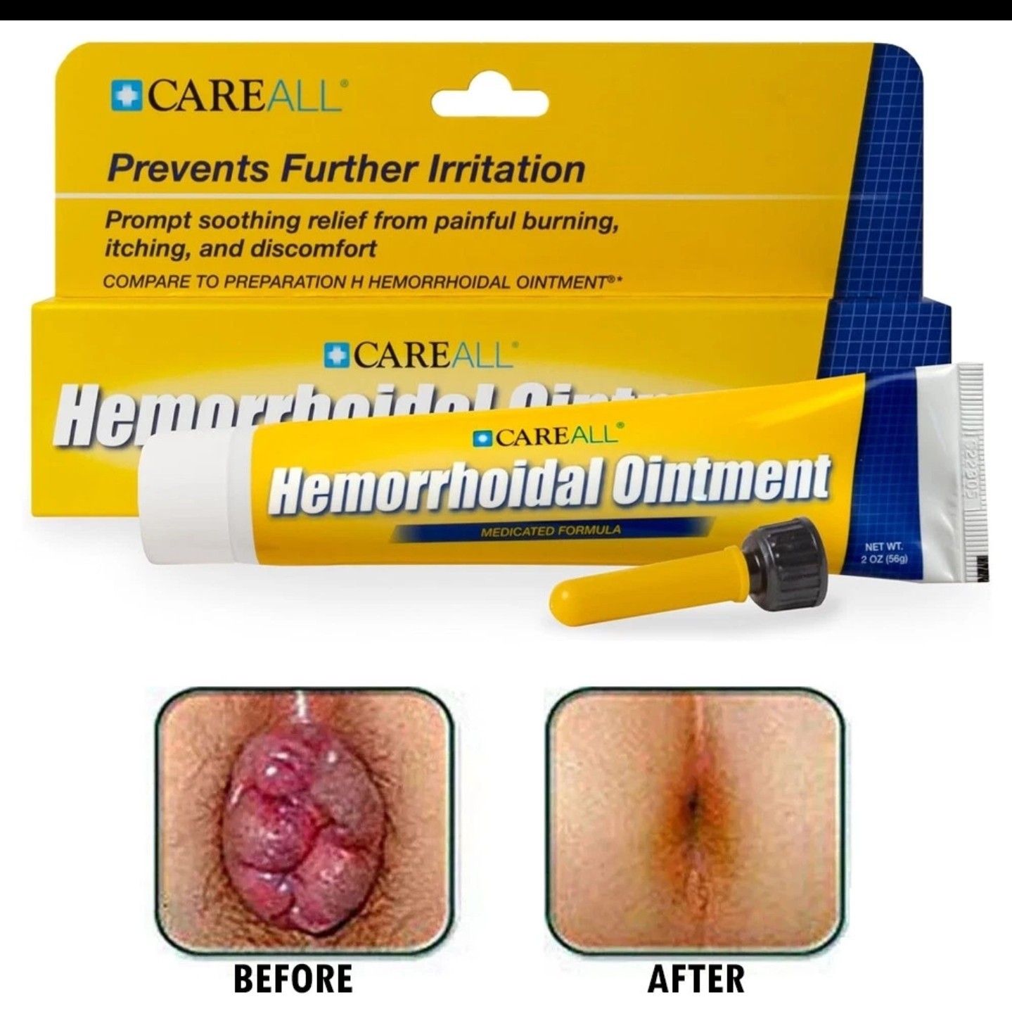 Crema Elimina Hemorroides con Aplicador Para Ayuda a Aliviar el Ardor y Dolor