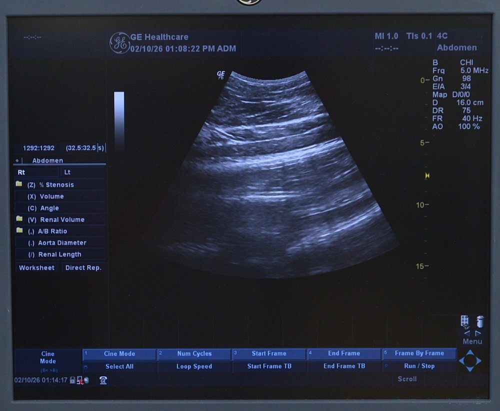 GE Logiq P6 Imaging System