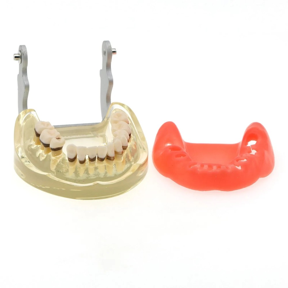 Dental Teeth Model Pathological Disease M4017 Removable Teaching Study Model
