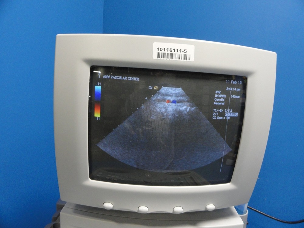 Siemens Acuson 4V2 Vector Array Ultrasound Probe – For Sequoia Series ~ 8588