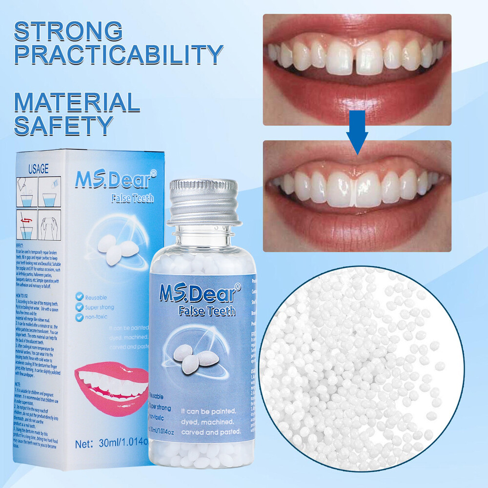 Temporary Tooth Repair Kit Temp Dental Repair Replace Missing Teeth DIY Moldable