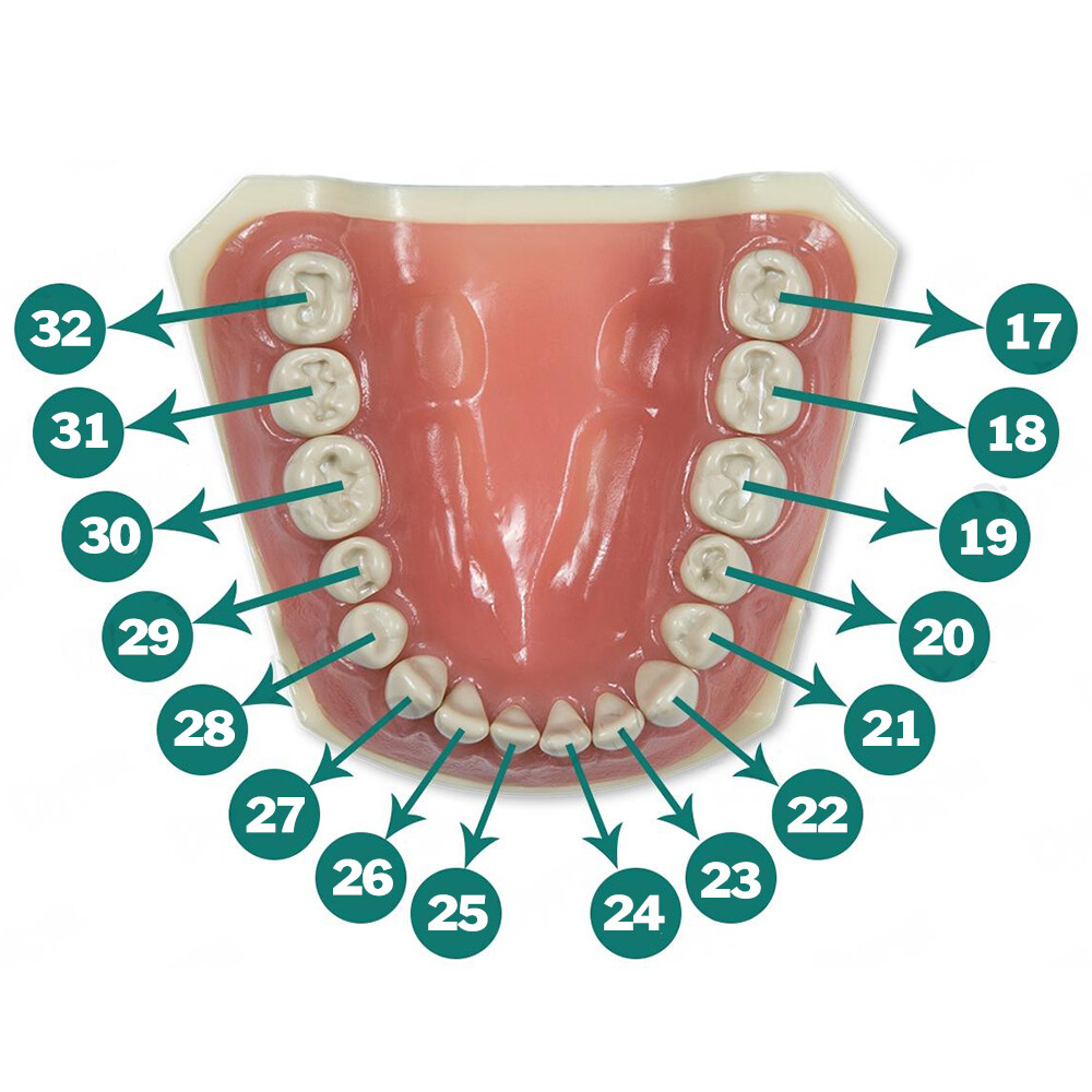 Typodont 860 Prep Teeth Crown and Cavity (5 pack) Compatible with Columbia 860