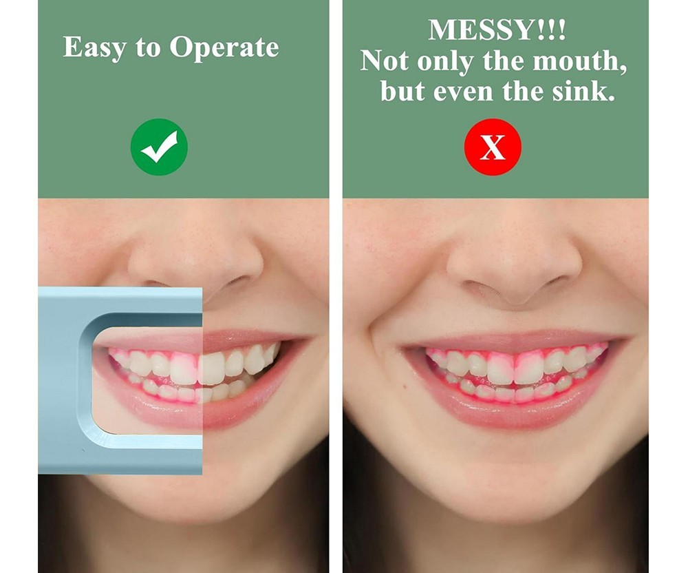 Electric Dental Plaque Indicator Detector Display Device Oral Hygiene Care Blue