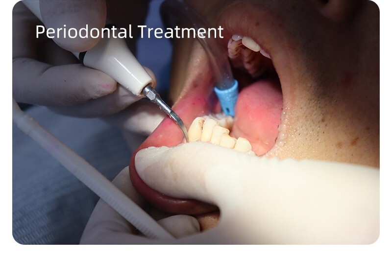 Dental Ultrasonic Piezo Scaler 2 Bottles Fits EMS Cavitron Woodpecker Handpiece