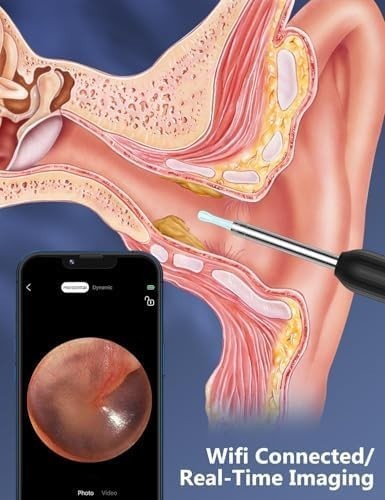 Wireless Ear Wax Remover Set with 8 Ear Set, Ear Cleaner Removal Kit with Camera