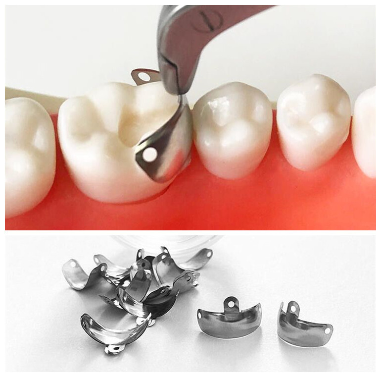 Dental Sectional Matrix Contoured Matrice Fits Triodent Clip Ring Matrices 32Pc