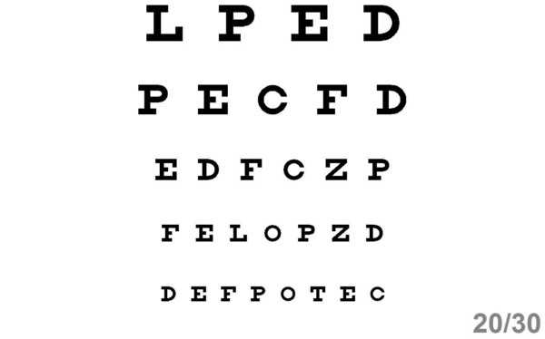 Ophthalmic Optometric Computerized Visual Acuity Software - Excellent Value