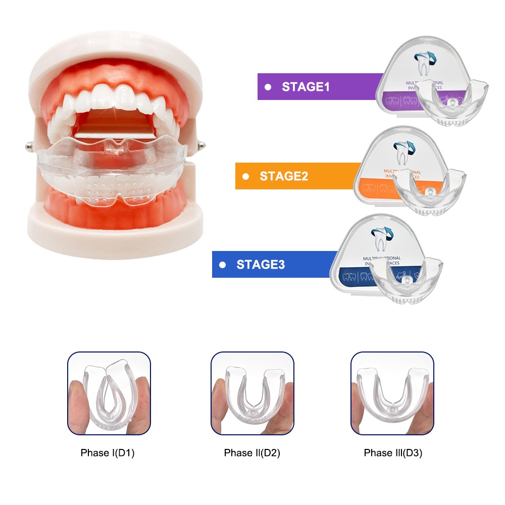 3 Stage Dental Orthodontic Teeth Corrector Braces Alignment Trainer Retainer