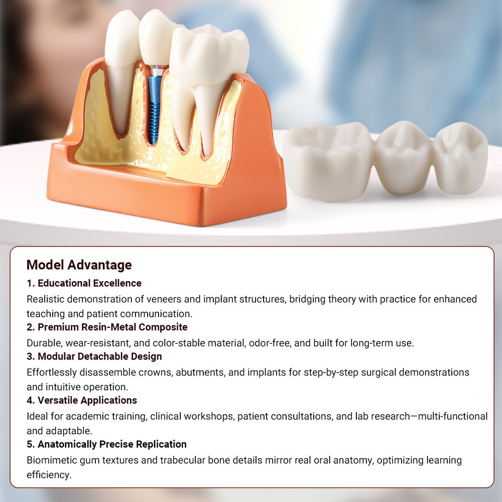 Dental 4Times Teeth Model Implant Analysis Crown Bridge Removable Study Training