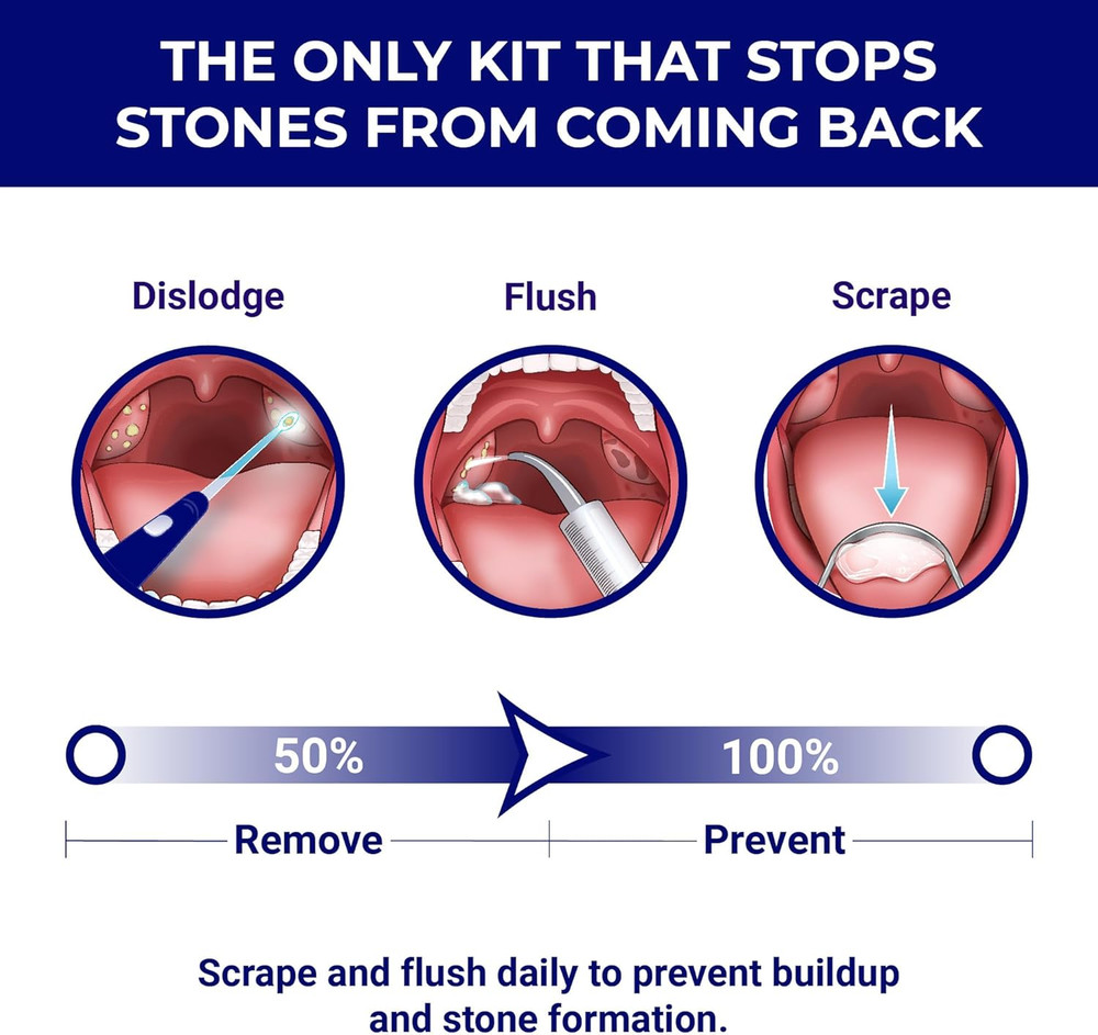 Tonsil Stone Remover - Tonsil Stone Removal Kit - Tonsillolith Remover Tool - To