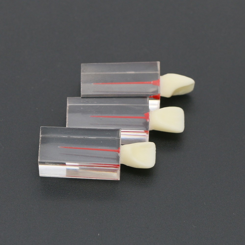 5Pcs Dental Root Canal Teeth molar Model Study Practice For Endodontic Pulp File