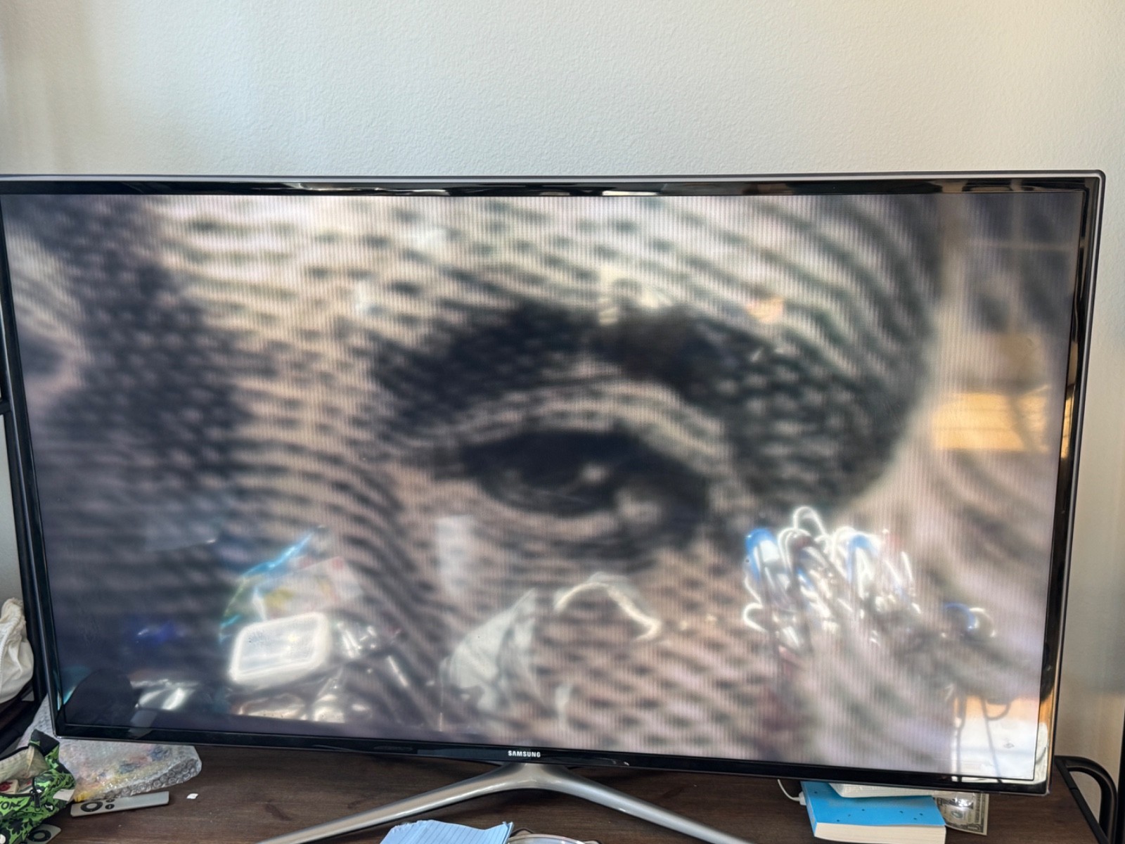 Miharu - Dental Intraoral Plaque Detection Camera Oral hygiene cleaning - RCA