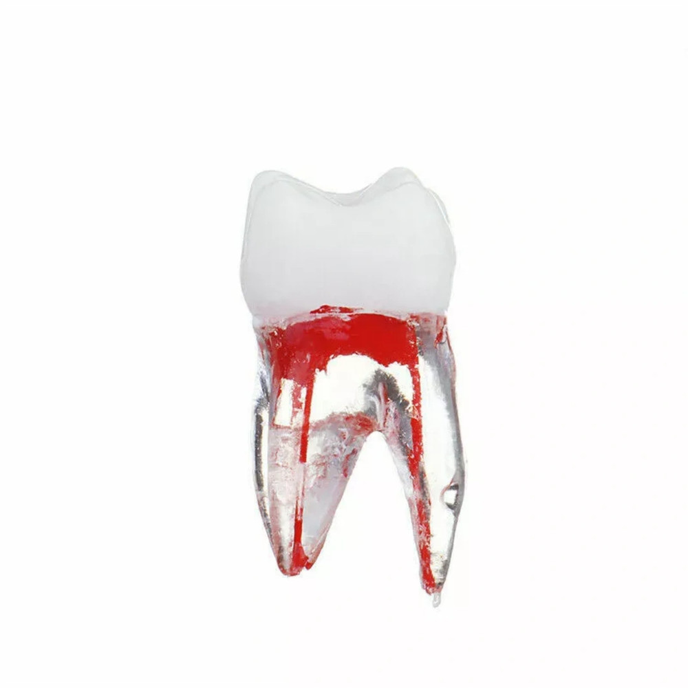 Dental Tooth Endo Root Canal Study Model For RCT Practice Blocks Pulp Cavity