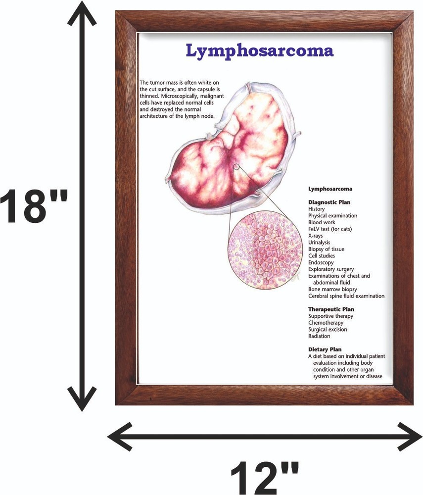 Lymphosarcoma Chart 12x18 inches