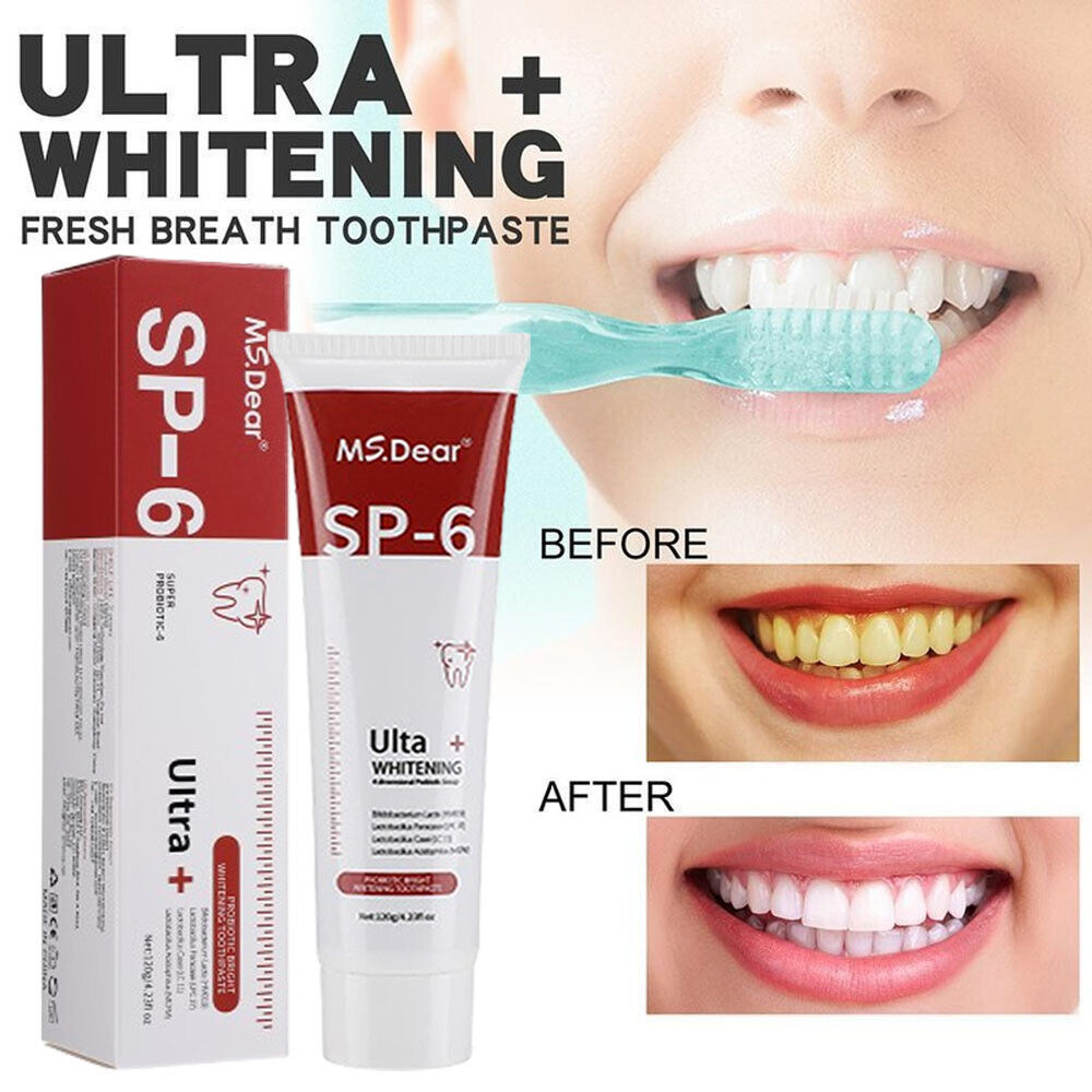 SP-6 Probiotic Toothpaste,Sp-6 Toothpaste Ultra Whitening Quick White Toothpaste
