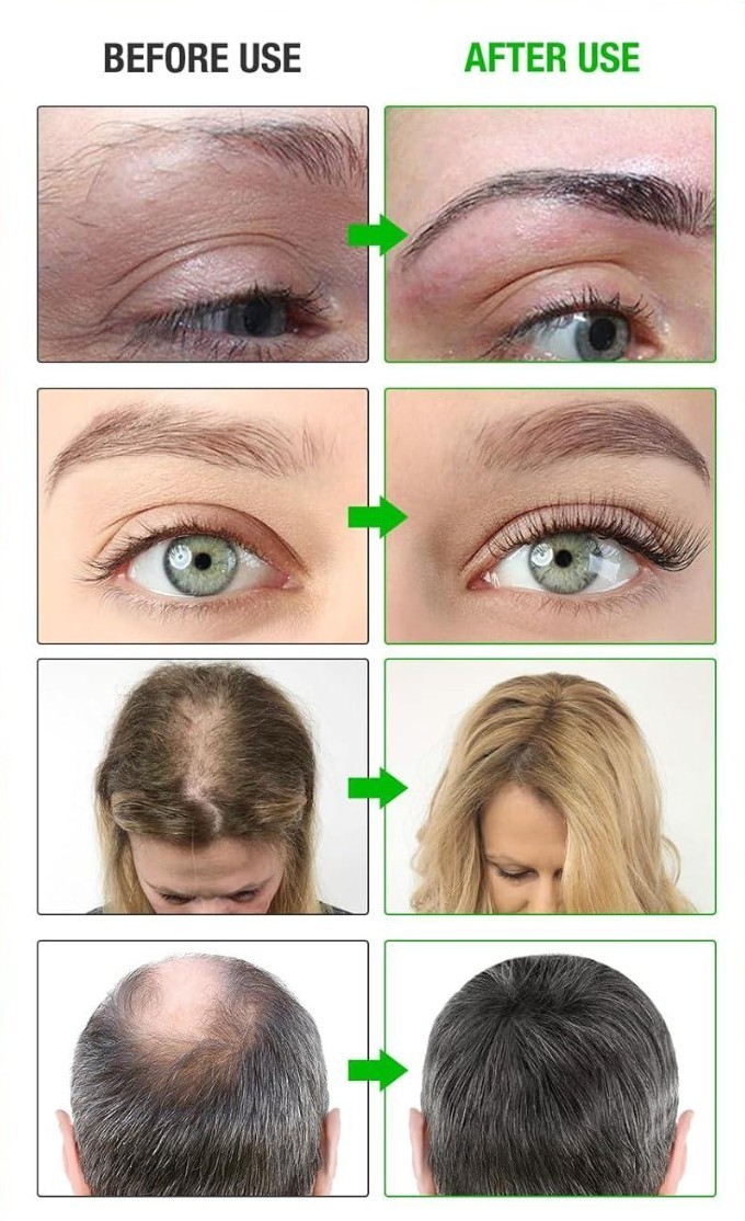 Rosemary Oil 100% Premium Therapeutic Grade Pure Virgin Natural, Hair Growth 4oz