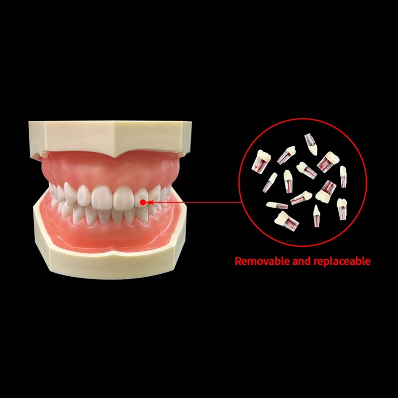 Endodontic Teeth Model Dental Practice Training Root Canal Model RCT Endo Teeth