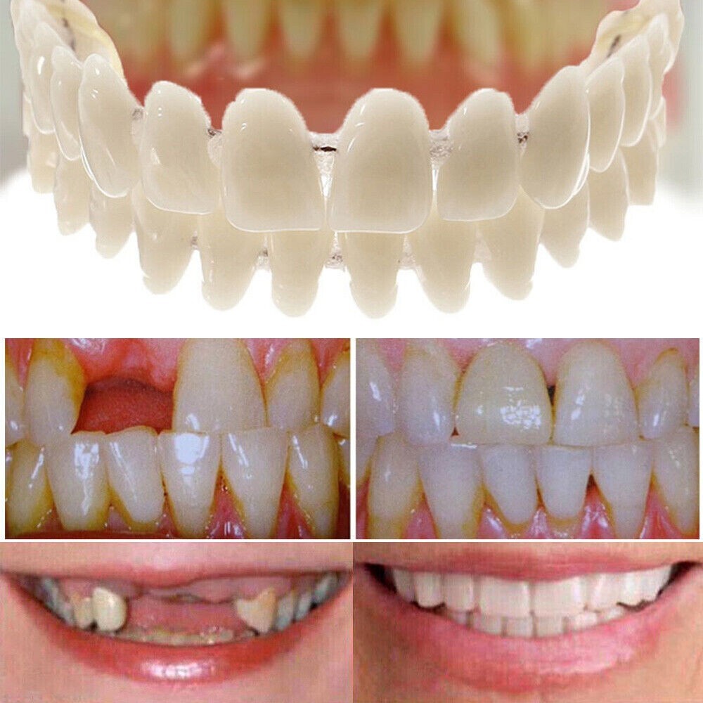 False Snap On Bottom/Upper Lower False Teeth Dental Veneers Dentures Fake Tooth
