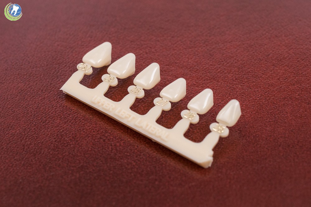 #10 Upper Left Lateral Anterior (ULL) Polycarbonate Crowns Caps Refills 6 Sizes