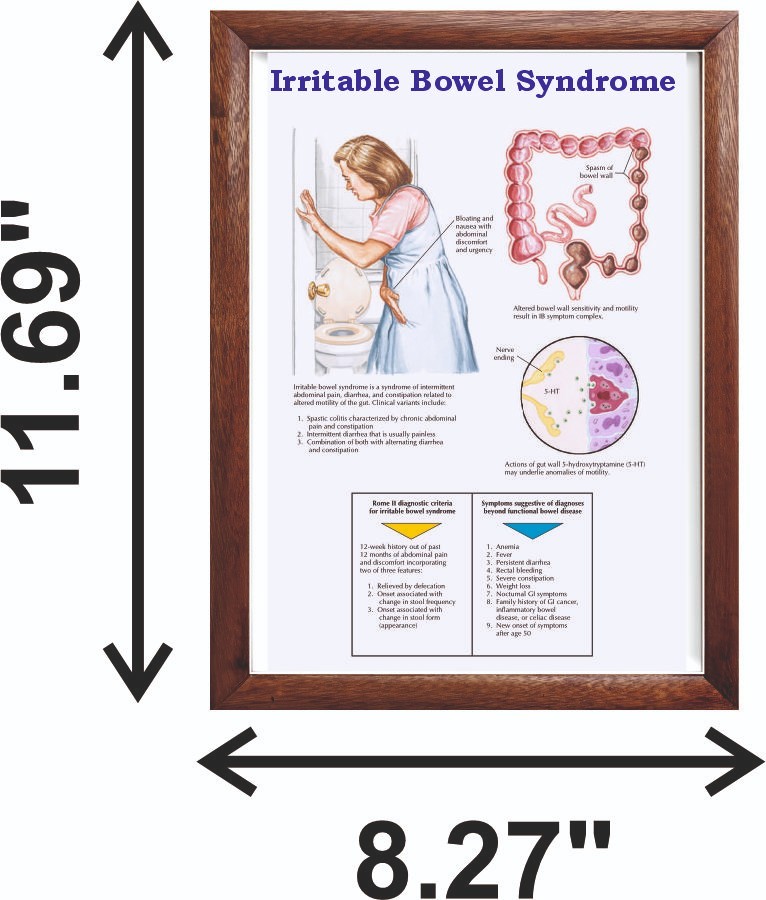 Irritable Bowel Syndrome Chart 12x18 inches