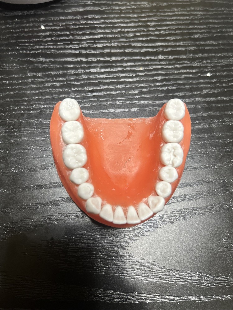 Perio Typodont Transparent Tissue with Calculus