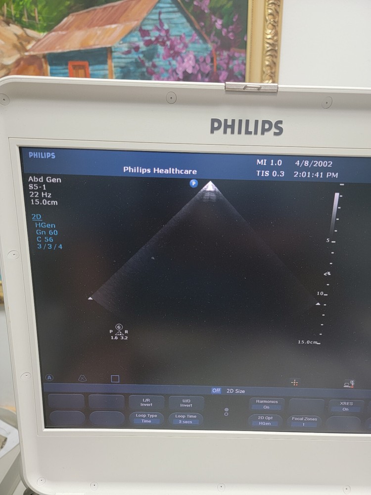 Portable Ultrasound