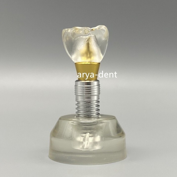 Dental Typodont Implant Teeth Model Demonstration Teeth Study Teach Model M2020