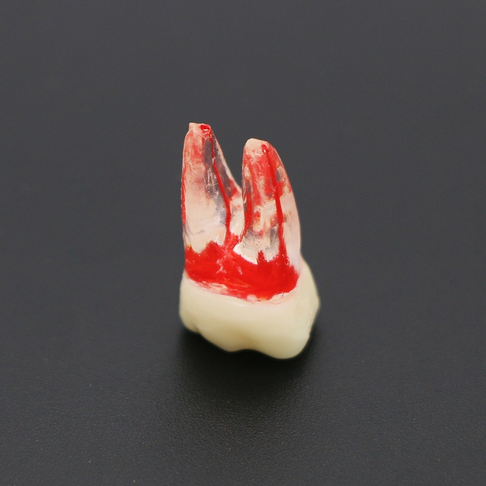Dental Teeth Root Canal RCT Block Pulp Cavity Practice Model for Endo File Study