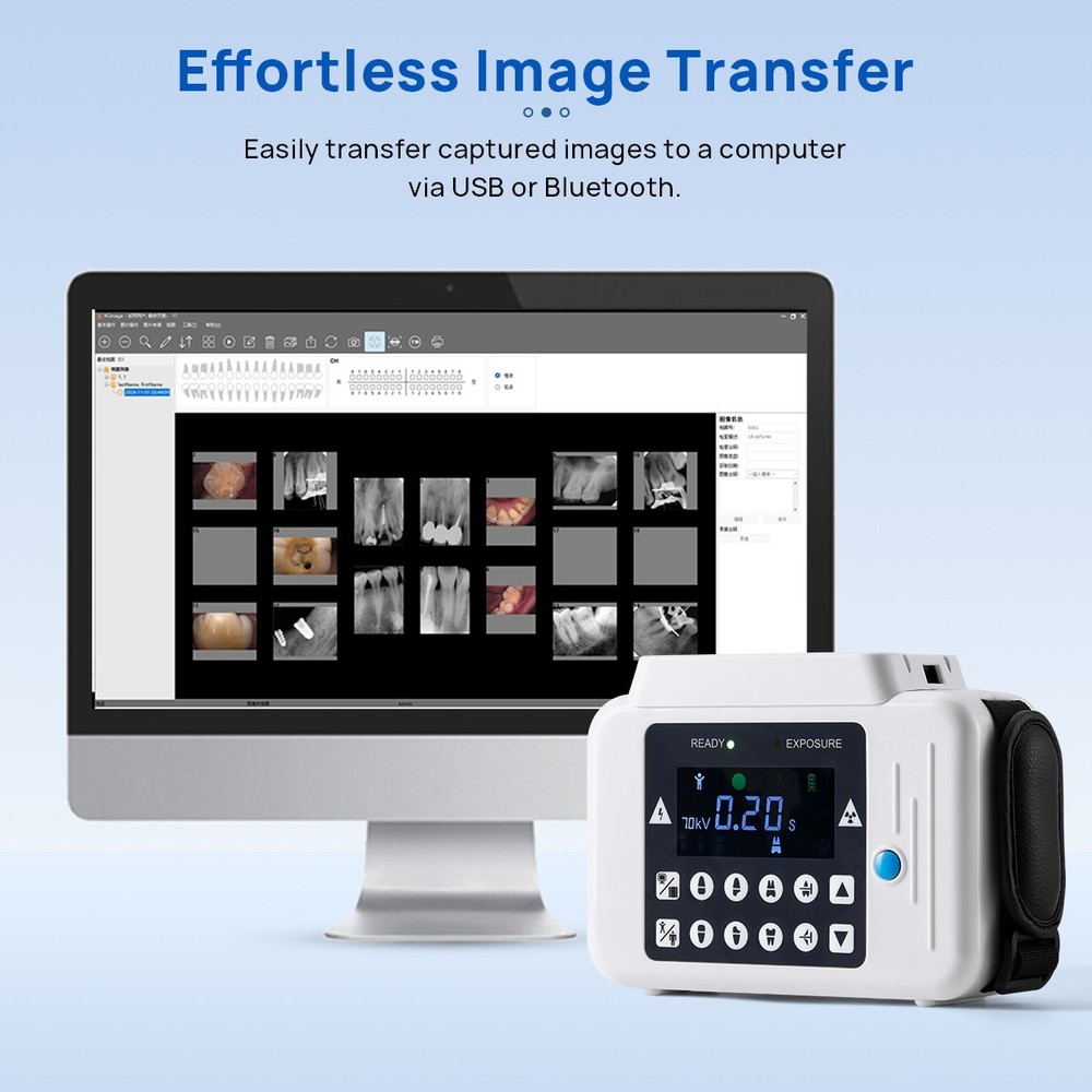 Handheld Portable Dental Ray Machine Unit with Built-in Display Screen no Shield