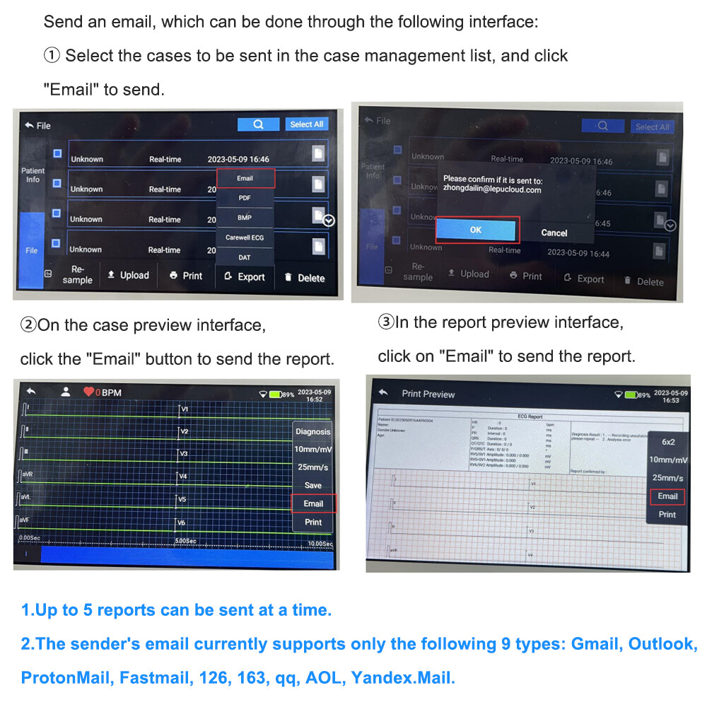 12-Lead ECG Machine Diagnostic Automatic Interpretation data transfer via email