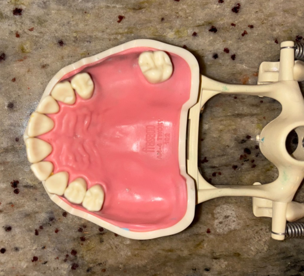 RPD/Partially Edentulous Typodont