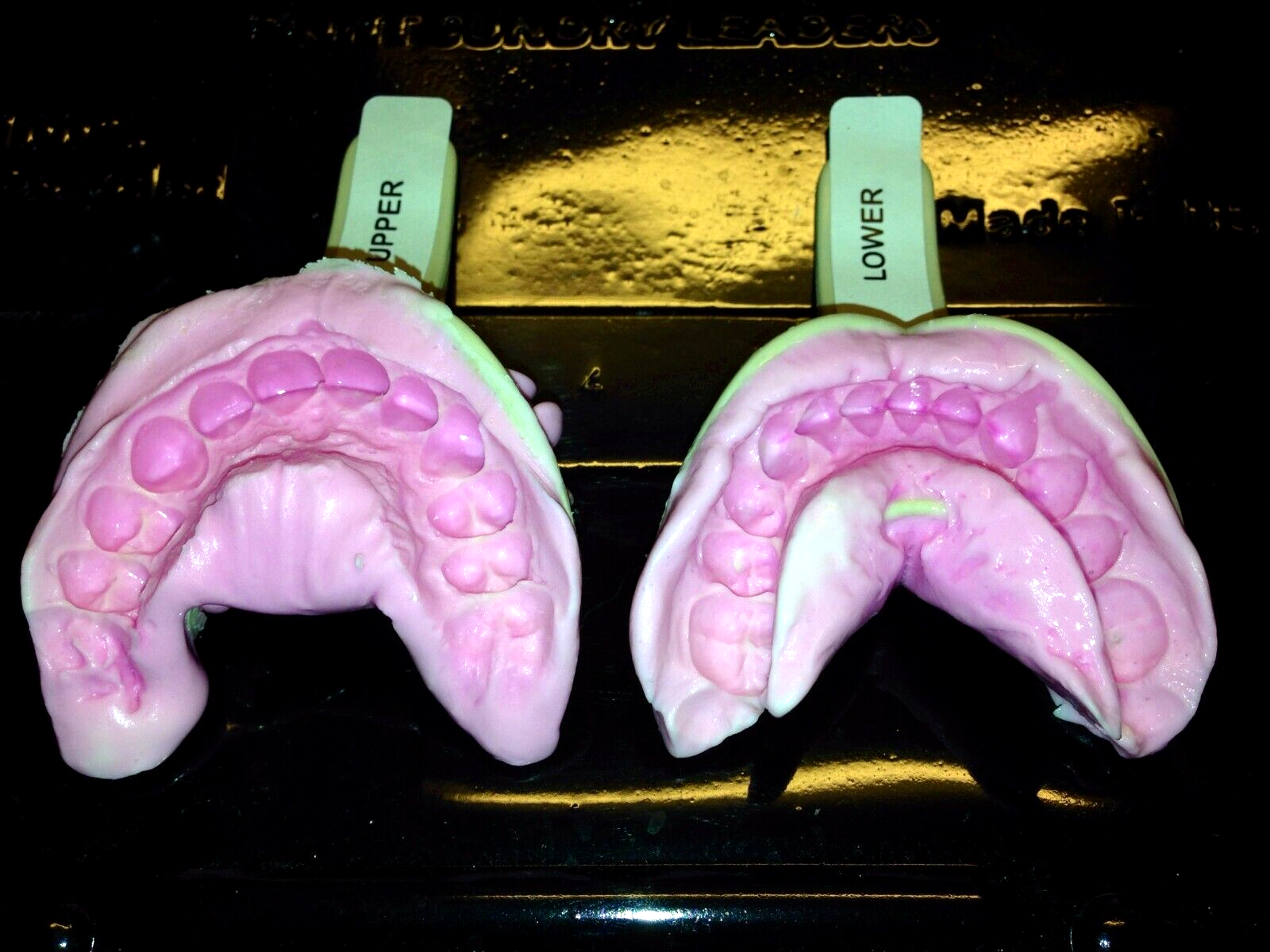Teeth Molding Impression Kit- Recommended to be used by our current clients