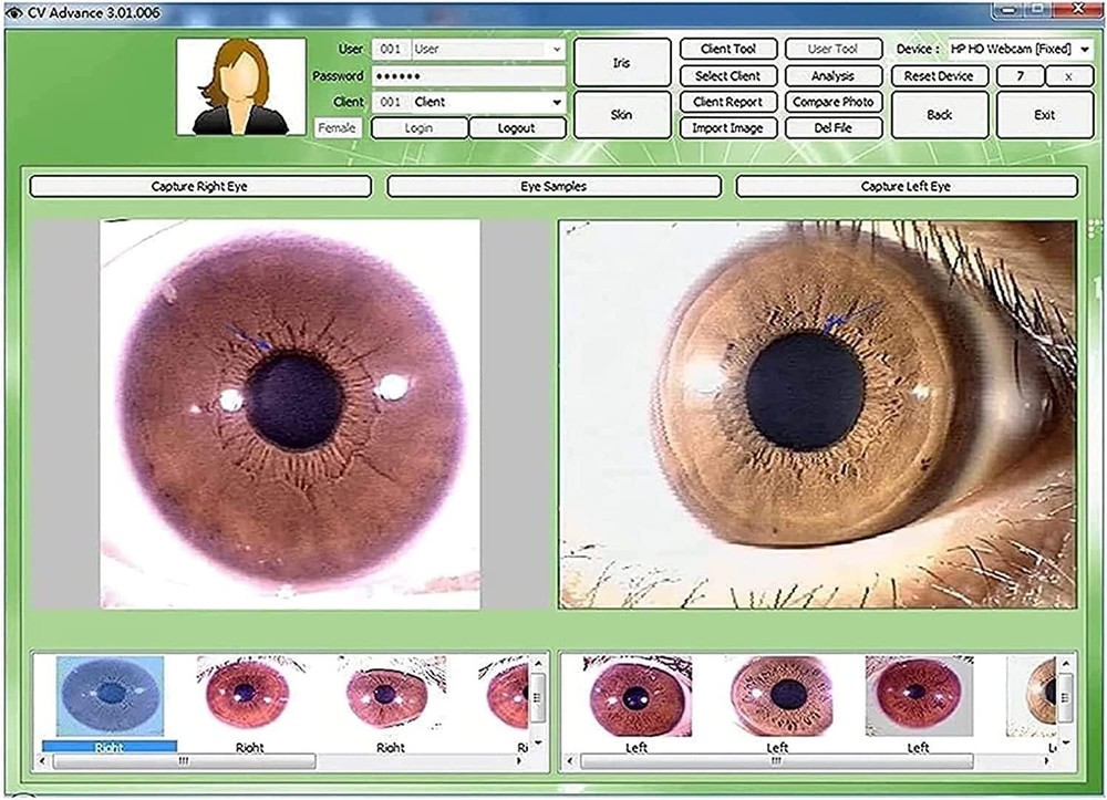 5.0 MP USB Iris Analyzer Iridology Camera with Pro Iris Software Analysis Camera