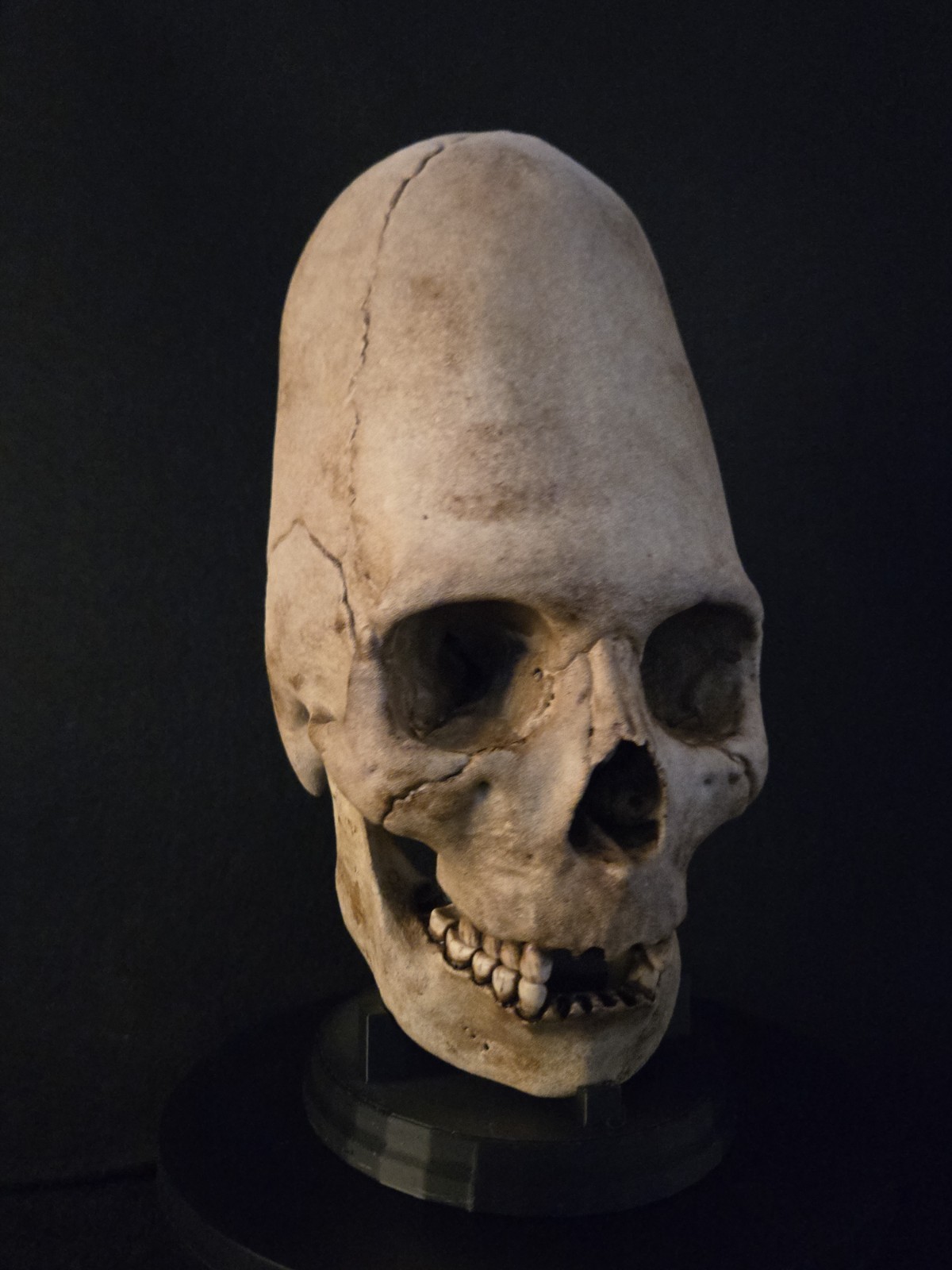 Human Skull - Peruvian Enlongated- Hyper Realistic with stand.