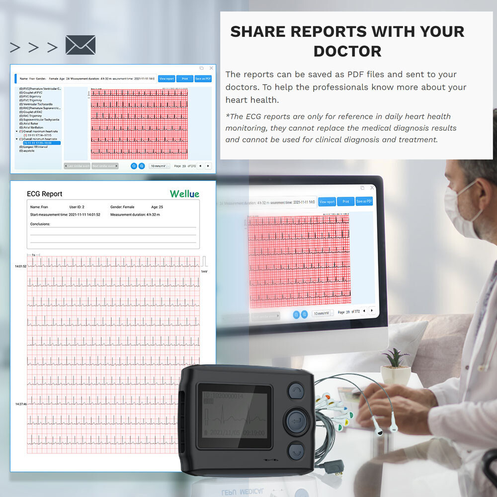 12 Lead Holter Monitor Recording 24h ECG and Heart Rate AI Analysis Abnormal ECG
