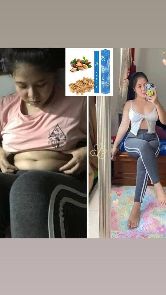 SKINNY Fast Slimគ្រាប់សម្រកធម្មជាតិ ស្គីននី ( 1ប្រអប់/ 30គ្រាប់ )