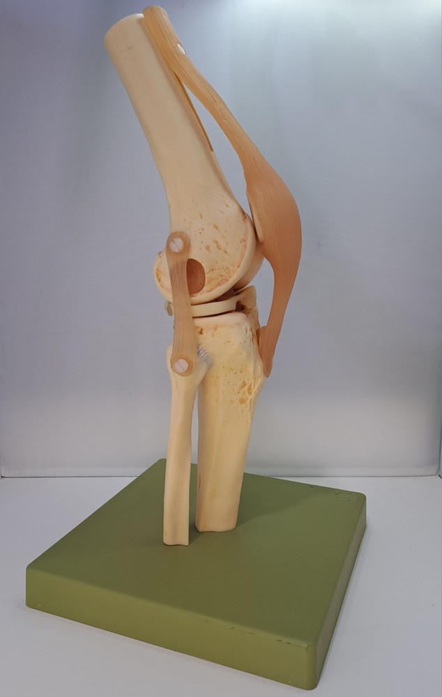 Vintage 1995 Somso Anatomical Model  Functional Knee Joint Model BIN86