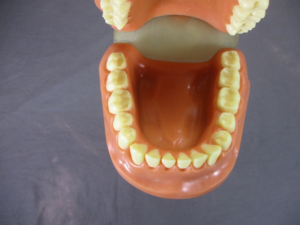 Dentist Typodont Dentoform Dental Model Teeth Overbite Tooth Display Hinged Set