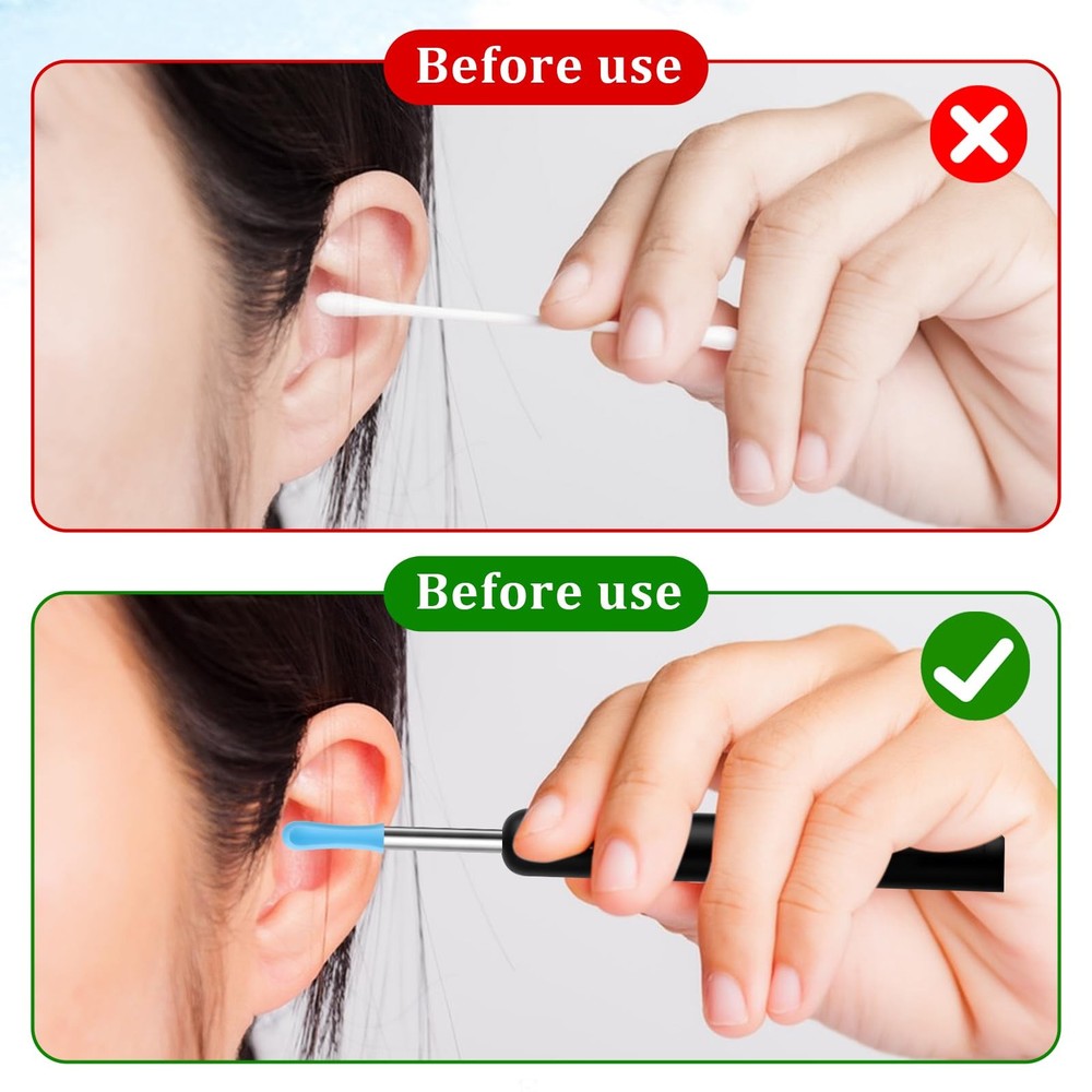 Ear Wax Removal Replacement Tips for Camera 30Pcs Spoon Blue