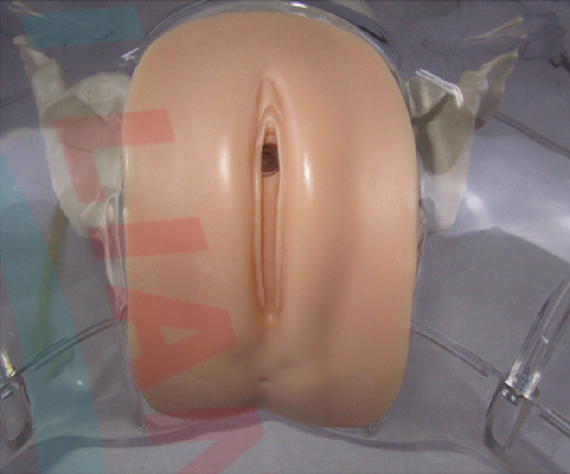 1:1 Human Female Transparent Catheterization Model Training Display Model