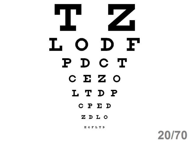 Ophthalmic Optometric Computerized Visual Acuity Software - Excellent Value