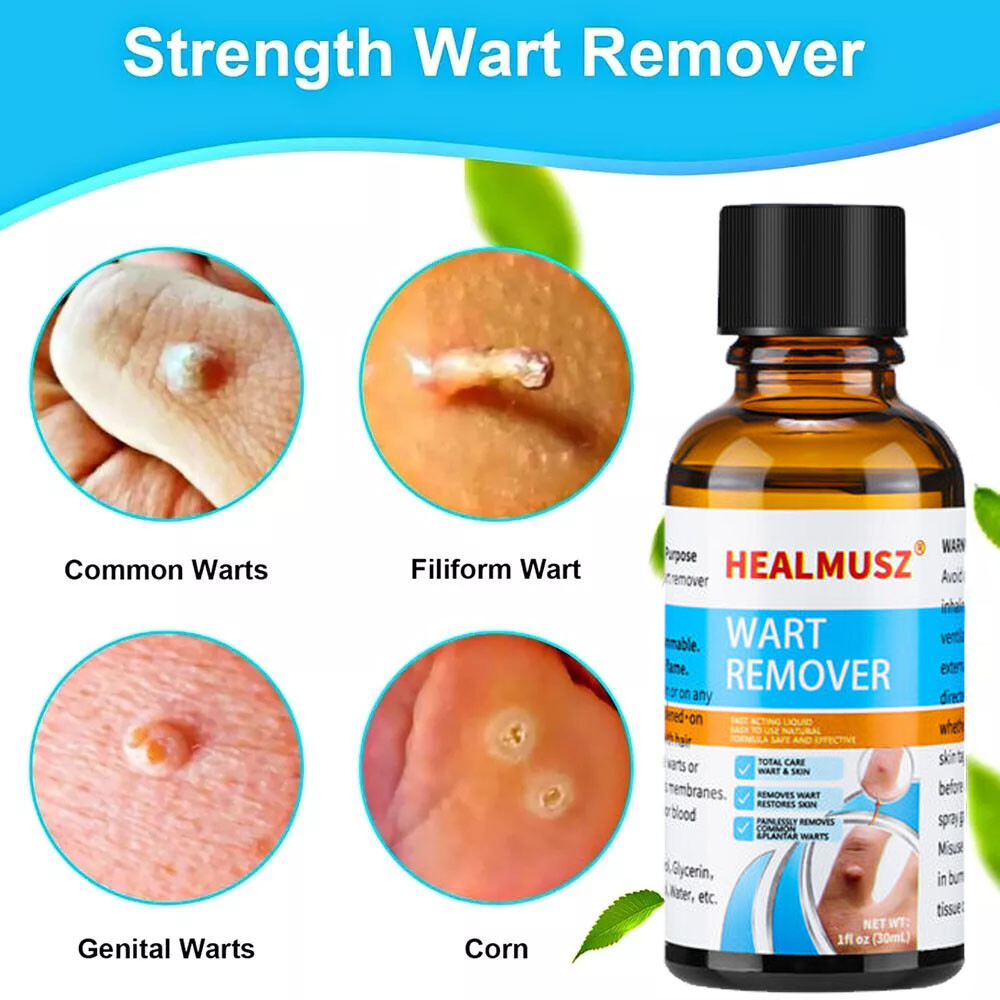 Wart Remover Liquid Skin Tag Mole Remover Eliminate Feet Corn Wart Remove Liquid